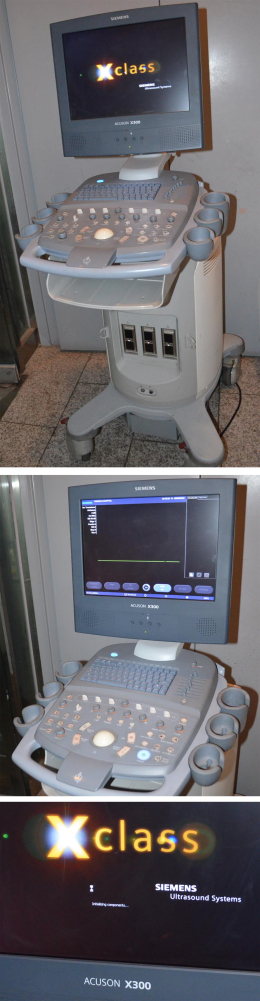 초음파진단기 SIEMENS Acuson X300 Ultrasound 제품 이미지 2